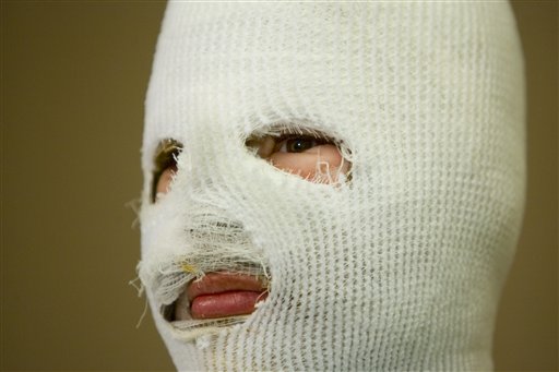 Acid Attack Hoax: Bethany Storro’s Acid Attack Self-Inflicted